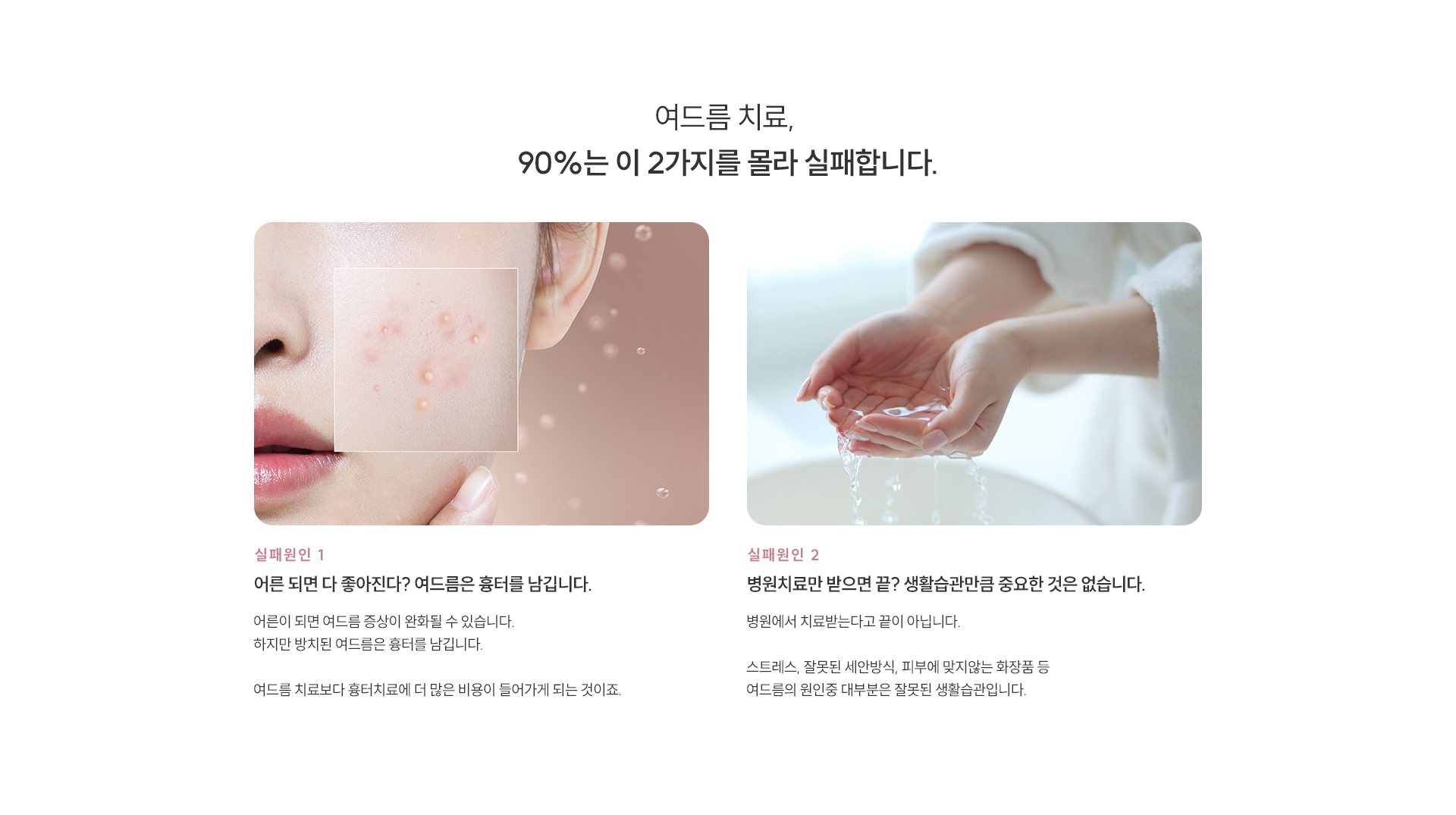 여드름/모공/흉터 제모 타이틀